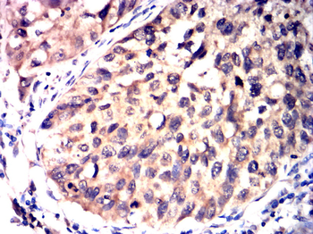 GLI1 Antibody
