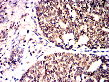 MMP9 Antibody