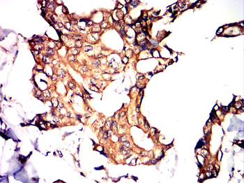 KRT19 Antibody