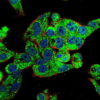 MMP13 Rabbit Polyclonal Antibody