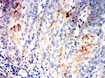 MMP13 Rabbit Polyclonal Antibody