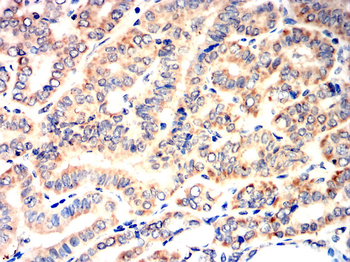 MMP13 Rabbit Polyclonal Antibody
