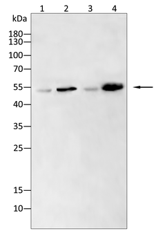 MMP13 Rabbit Polyclonal Antibody
