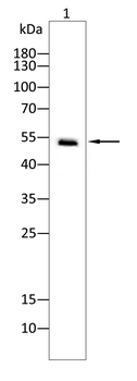 MMP13 Rabbit Polyclonal Antibody