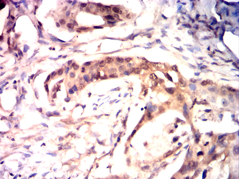 SUMO1 Antibody