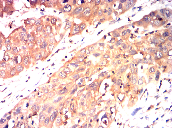KRT19 Antibody
