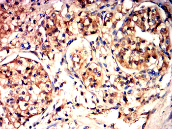 TBK1 Antibody