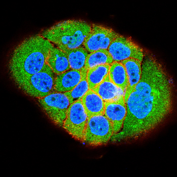 IKBKB Antibody