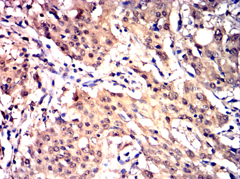 STAT6 Antibody