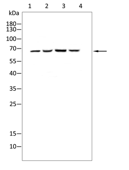 AFP Antibody