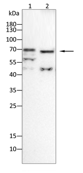 AFP Antibody