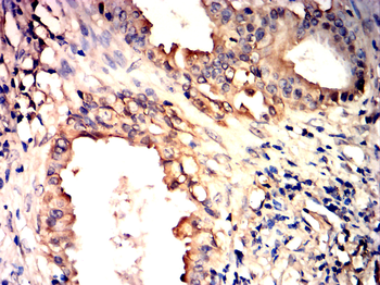 KRT18 Antibody