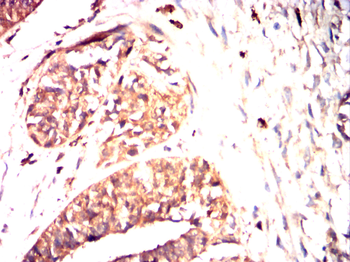 S100A8 Antibody
