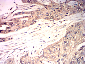 GSDME Antibody