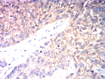 FGFR3 Antibody