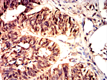 FGFR3 Antibody
