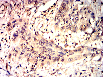 FAP Antibody