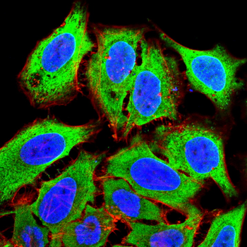 IL5 Rabbit Polyclonal Antibody