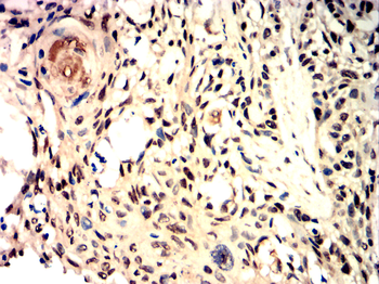 IL5 Rabbit Polyclonal Antibody