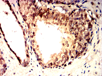 IL5 Rabbit Polyclonal Antibody