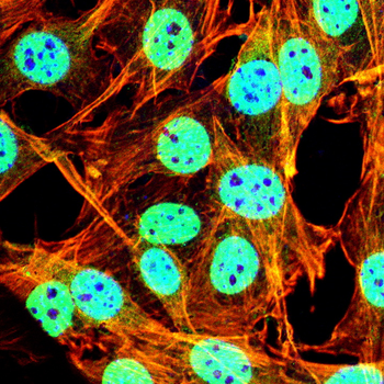 TOMM20 Antibody