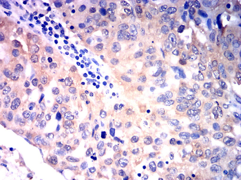 HSPB1 Antibody
