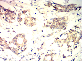 PGR Antibody
