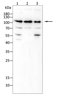 PGR Antibody