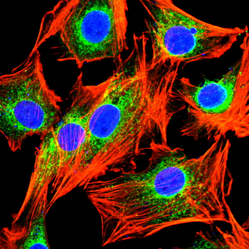 PDGFRB Antibody