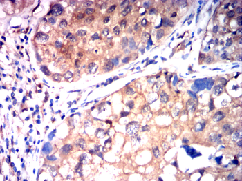 PDGFRB Antibody