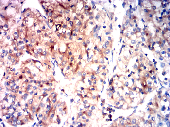 PDGFRB Antibody