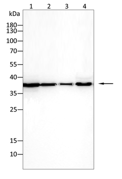 PDGFRB Antibody