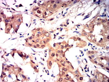 PRKCA Antibody