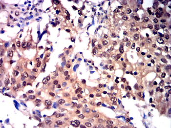 PRKCA Antibody