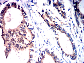 PRKCA Antibody