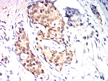 PRKCD Antibody