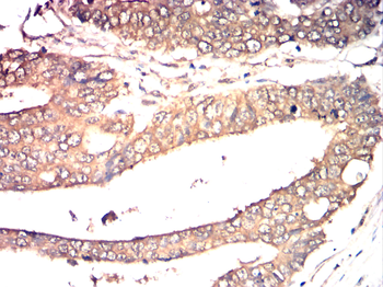 PRKCD Antibody