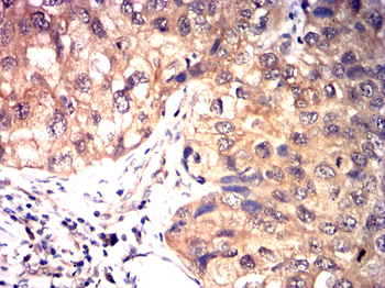 CDK1 Antibody