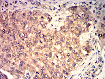 CDK1 Antibody