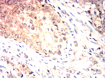 MTOR Antibody