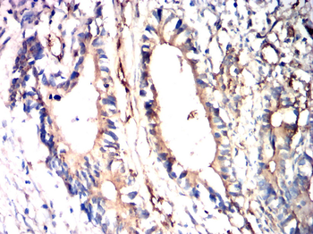 MTOR Antibody