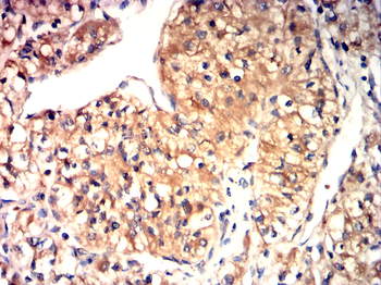 MTOR Antibody