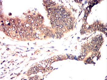 MTOR Antibody