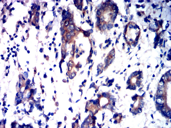 RTN4 Antibody