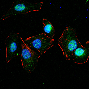 RTN4 Antibody