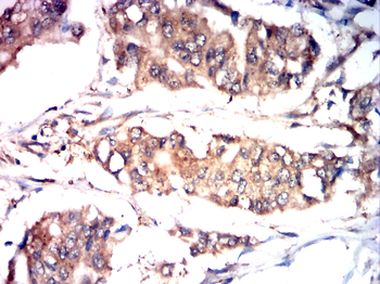 RTN4 Antibody