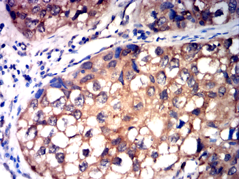 RTN4 Antibody