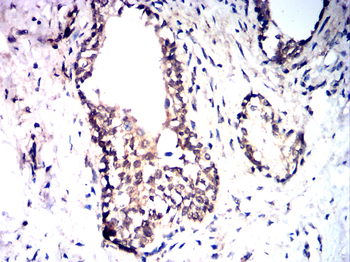 RTN4 Antibody
