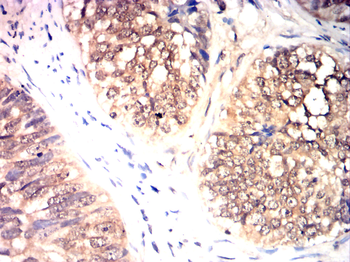 DCX Antibody