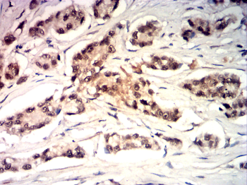 CYP1B1 Antibody